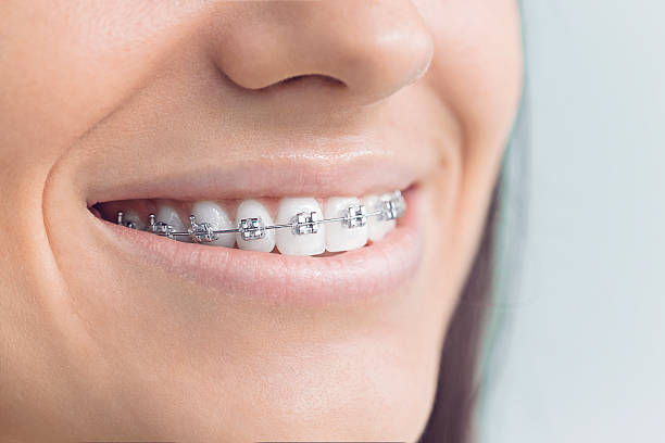 Best TMJ/TMD Treatment  in Lake Sarasota, FL